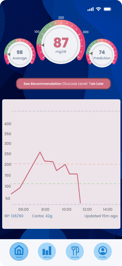 Dashboard at 87 mg/dl with See Recommendation, Glucose Level: Too Low, and a falling trend line